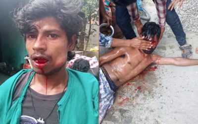We Helped Three Dalit Brothers Assaulted By A Mob, With Medical Expenses And A Food Business